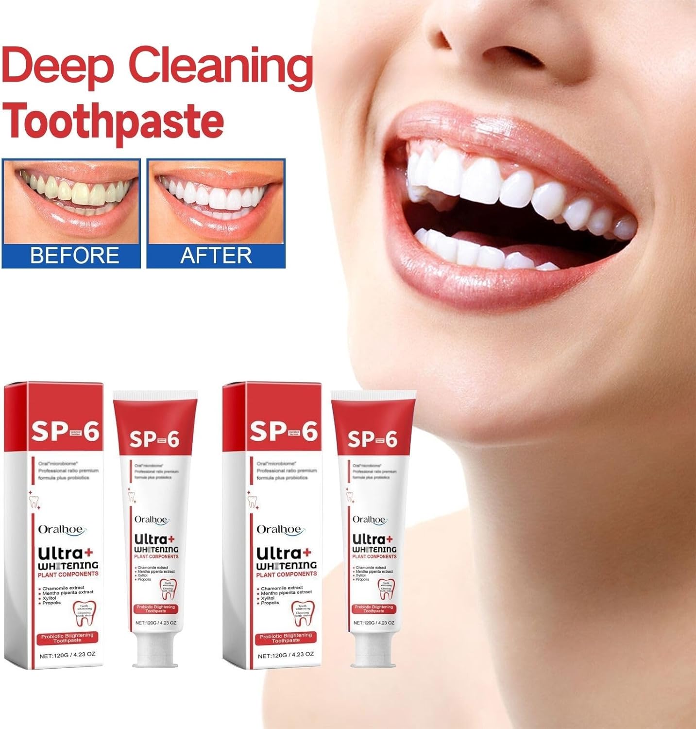2 Pcs SP-6 Ultra Whitening Toothpaste – Deep Cleaning & Probiotic Brightening - Infinitygallery.store