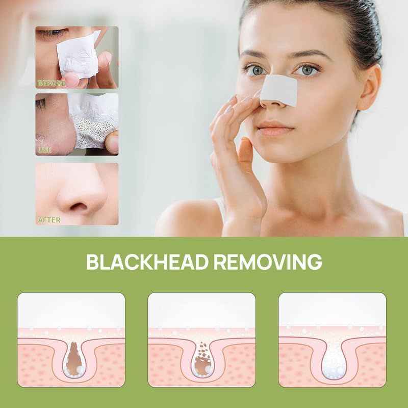 LANBENA Blackhead Remover Cream – Deep Cleansing Pore Purifying Mask