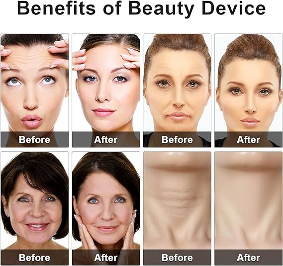 ✨ Eye Beauty Device – Portable Skincare Wand with Red & Blue Light Therapy | Glow On-the-Go - Infinitygallery.store