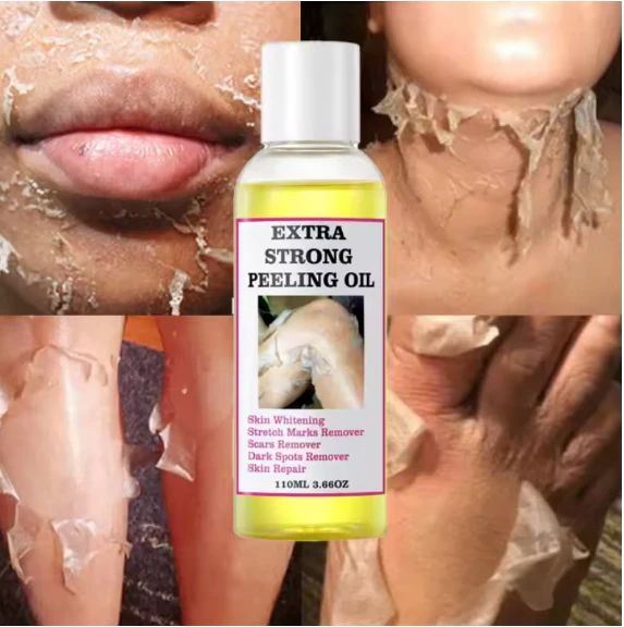 Peeling Oil (110ml) – Gentle Whitening & Skin Renewal Exfoliator - Infinitygallery.store