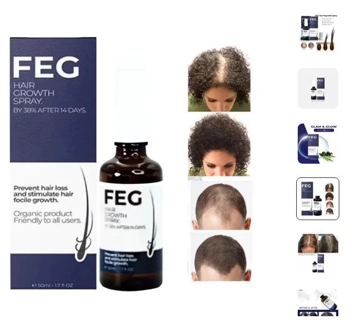 FEG Hair Growth Spray – Natural Hair Restoration & Thicker, Healthier Hair - Infinitygallery.store