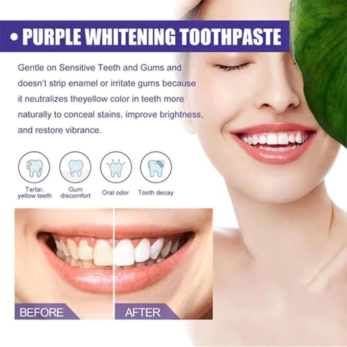 ✨ Purple Whitening Toothpaste – Color Corrector for Bright, Radiant Smiles - Infinitygallery.store