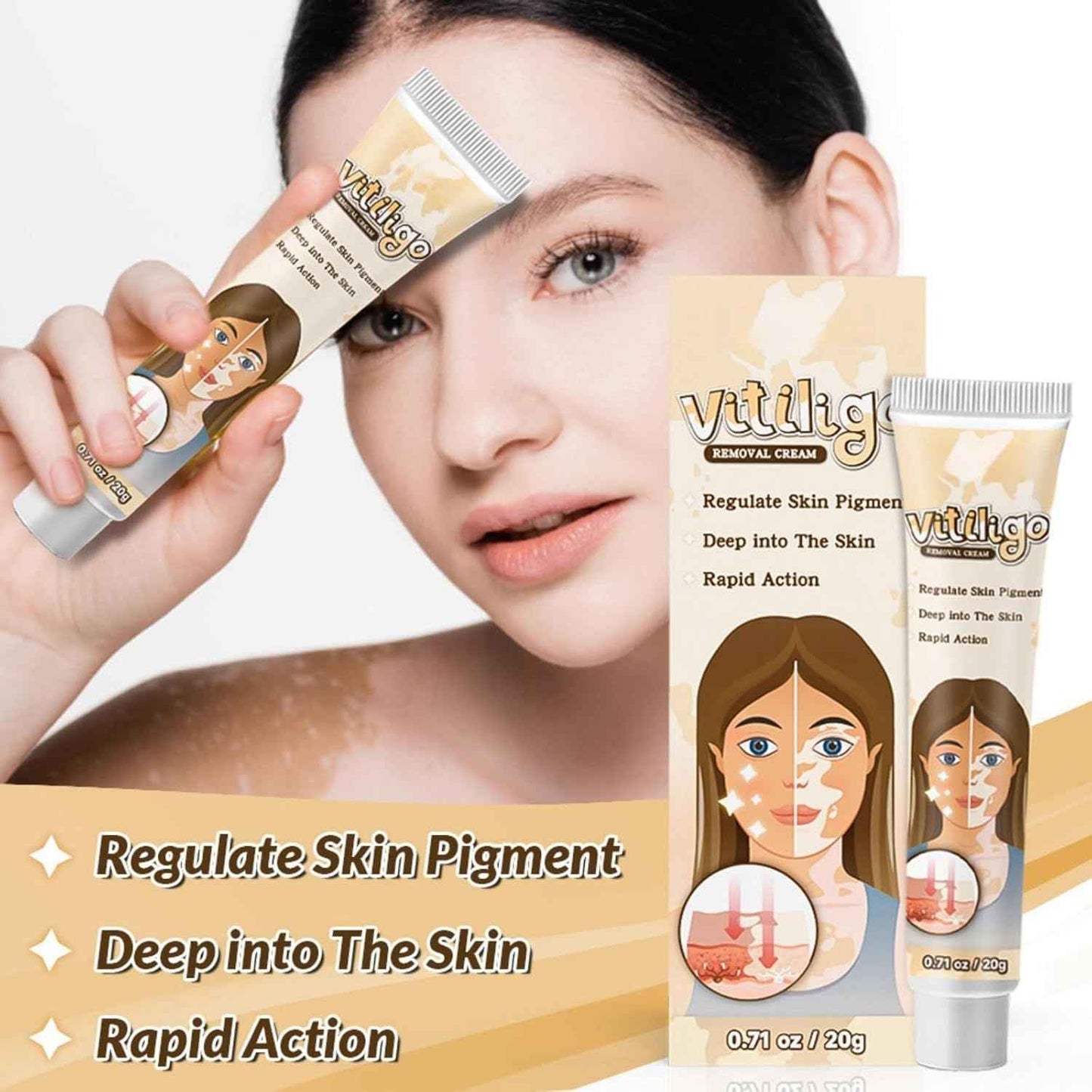 Vitiligo Removal Cream – Restore Skin Pigment & Even Skin Tone Naturally