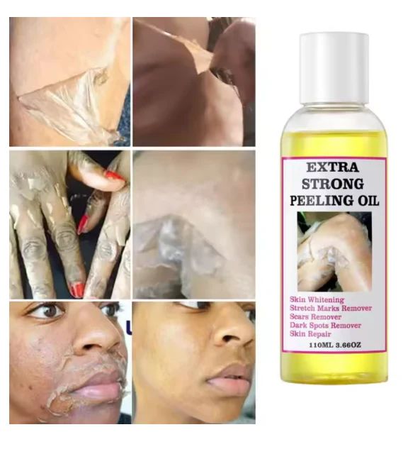 Peeling Oil (110ml) – Gentle Whitening & Skin Renewal Exfoliator - Infinitygallery.store