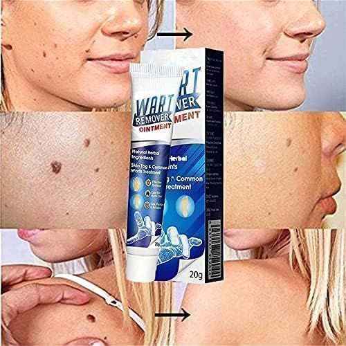 Wart & Skin Tag Remover Cream – Professional-Grade XIBLA Ointment (Home Use)