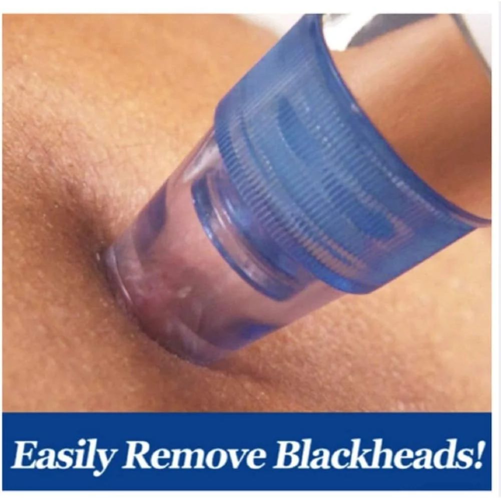 5-Level Pore Vacuum Blackhead Remover with 4 Probes – USB Rechargeable Deep Cleaner - Infinitygallery.store