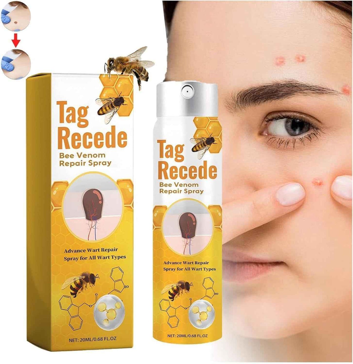 Tag Recede Bees Treatment Spray – Smooth Skin with P-Venom, 20ml