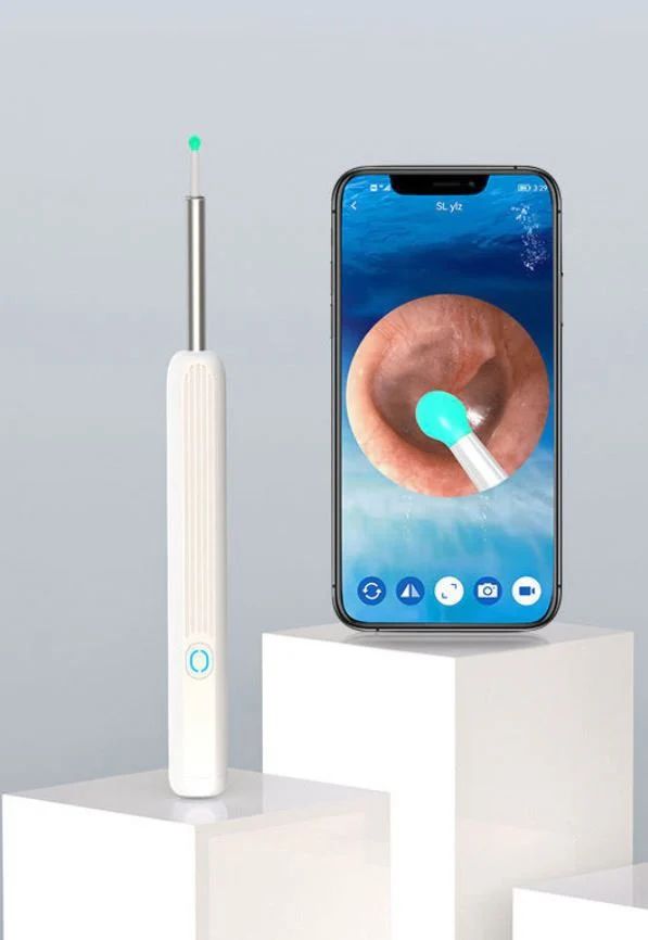 Wireless HD Earwax Removal Kit with Camera – iOS & Android Compatible, Type-C Rechargeable - Infinitygallery.store
