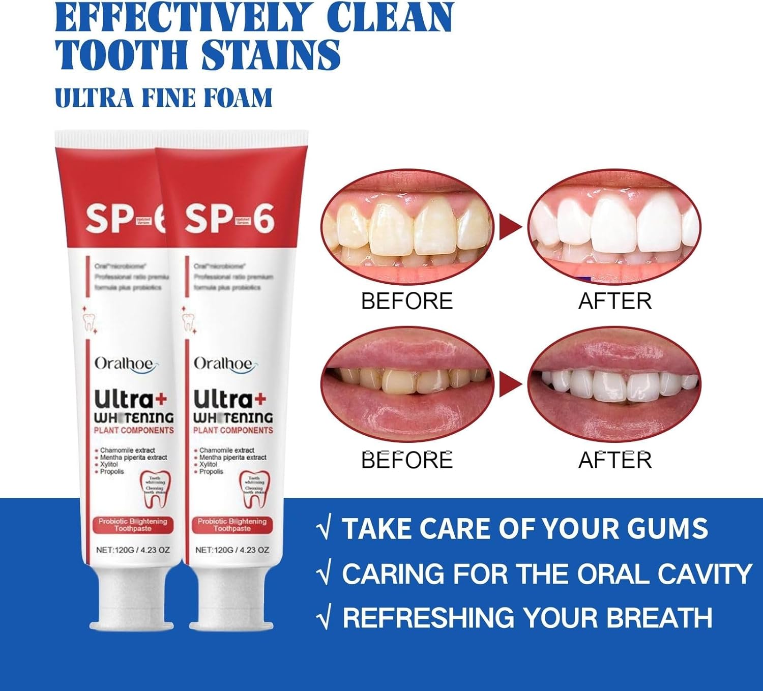 2 Pcs SP-6 Ultra Whitening Toothpaste – Deep Cleaning & Probiotic Brightening - Infinitygallery.store