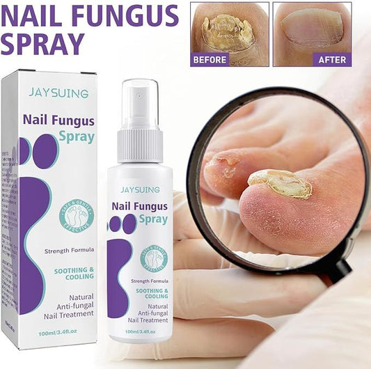Nail Fungus Treatment Spray – Fast, Safe Relief for Hands & Feet - Infinitygallery.store