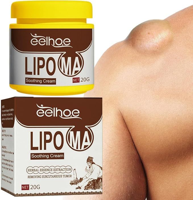 Natural Herbal Body Care Balm – 20g Fat Dissolving & Lipoma Removal Cream - Infinitygallery.store