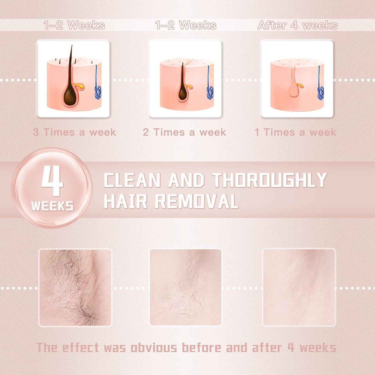 IPL Laser Hair Removal Device – 999,999 Flashes for Women & Men | Safe, Painless, At-Home Use