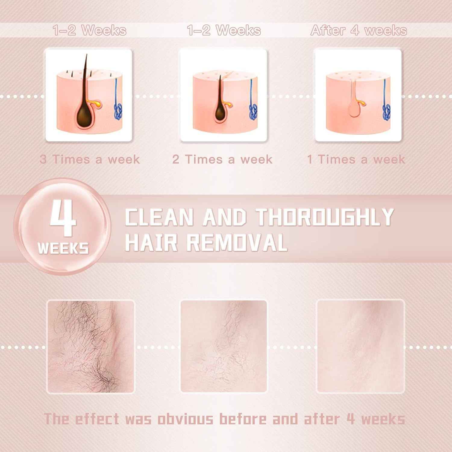 IPL Laser Hair Removal Device – 999,999 Flashes for Women & Men | Safe, Painless, At-Home Use