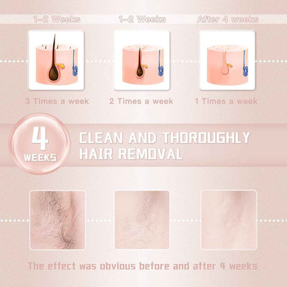 IPL Laser Hair Removal Device – 999,999 Flashes for Women & Men | Safe, Painless, At-Home Use