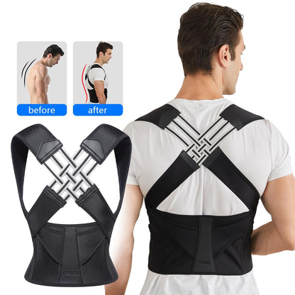 Adjustable Posture Corrector Belt for Back, Spine & Shoulder Support – Unisex Brace (M–XXL) - Infinitygallery.store