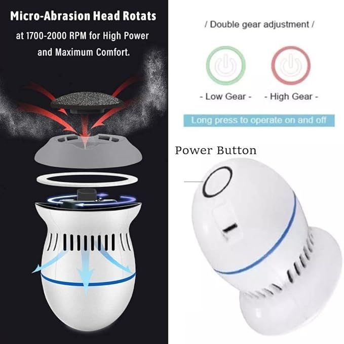 Electric Callus Remover – Rechargeable Foot File for Smooth & Radiant Feet - Infinitygallery.store