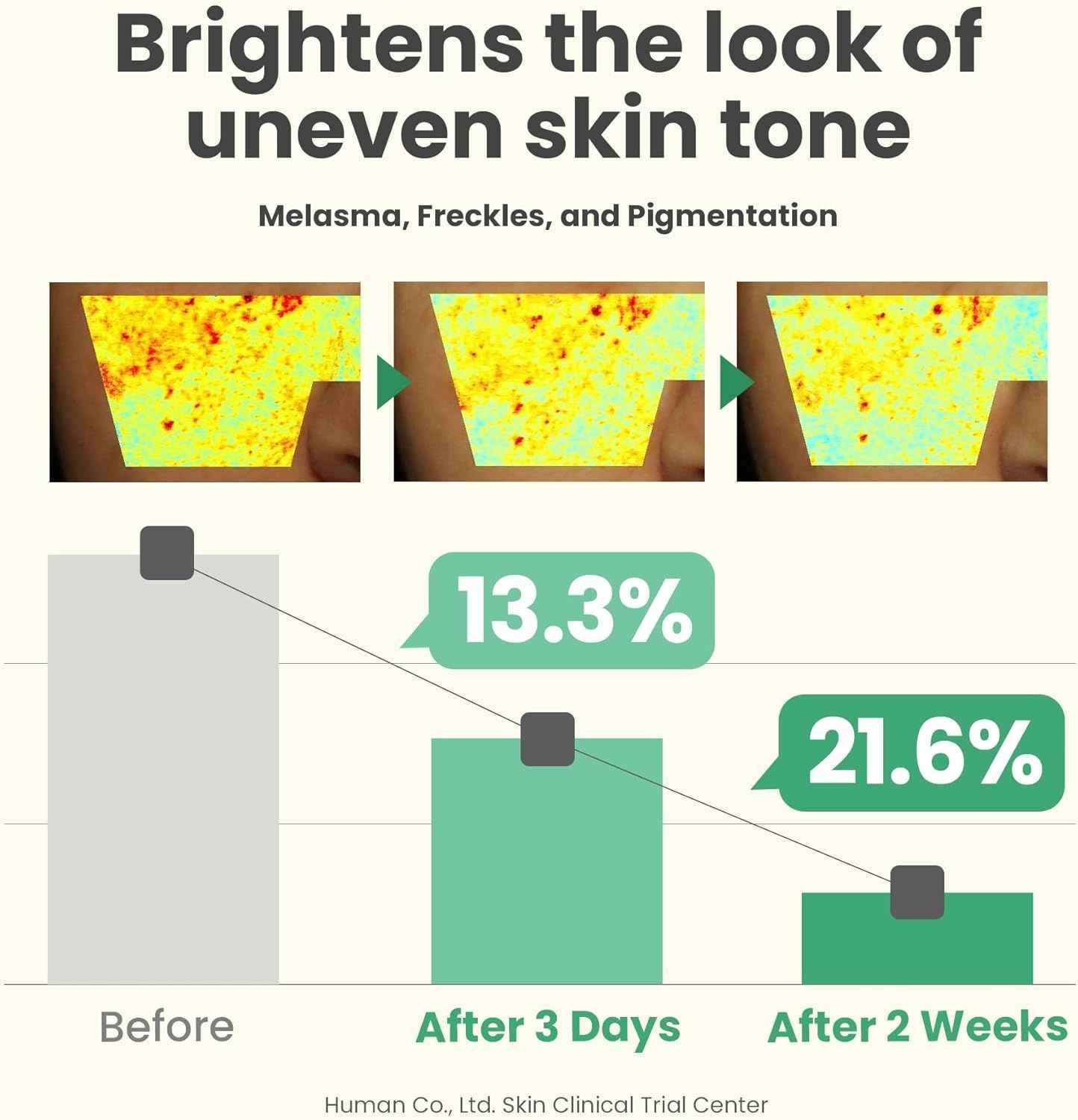 Dark Spot Correcting Cream – Brightening & Hyperpigmentation Treatment
