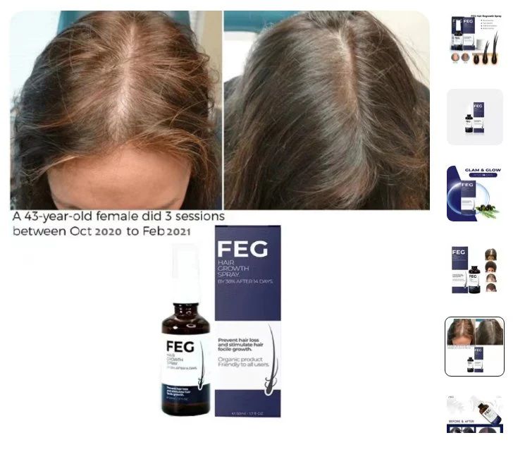 FEG Hair Growth Spray – Natural Hair Restoration & Thicker, Healthier Hair - Infinitygallery.store