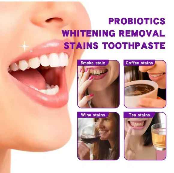 Deep Clean Whitening Toothpaste 120g – Fights Plaque, Brightens Teeth, Freshens Breath