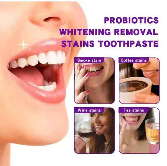 Deep Clean Whitening Toothpaste 120g – Fights Plaque, Brightens Teeth, Freshens Breath