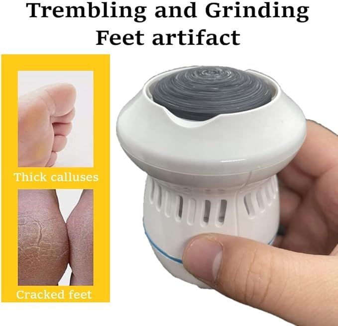 Electric Callus Remover – Rechargeable Foot File for Smooth & Radiant Feet - Infinitygallery.store