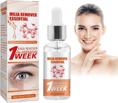 Milia Remover Essential Serum – Eye Fat Particle Removal & Hydration