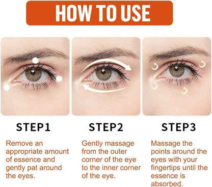 Milia Remover Essential Serum – Eye Fat Particle Removal & Hydration