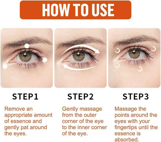 Milia Remover Essential Serum – Eye Fat Particle Removal & Hydration