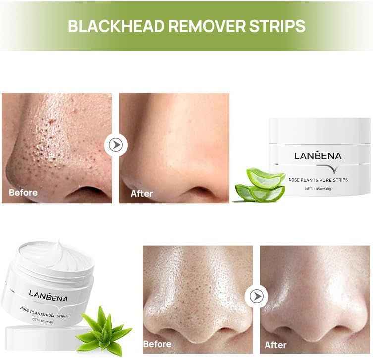 LANBENA Blackhead Remover Cream – Deep Cleansing Pore Purifying Mask