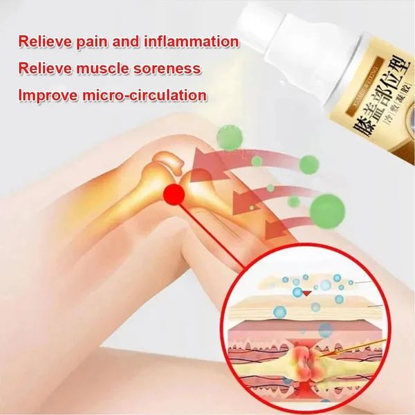 ❄️ Knee Pain Relief Cold Spray – Instant Cooling Relief for Joints & Muscles (35ml) - Infinitygallery.store