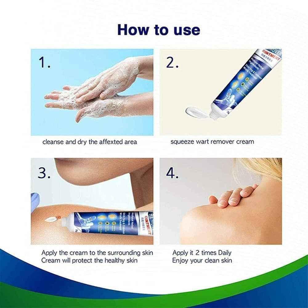 Wart & Skin Tag Remover Cream – Professional-Grade XIBLA Ointment (Home Use)