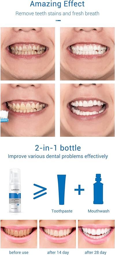 ✨ Teeth Whitening Mousse – Intensive Baking Soda Tooth Cleanser for Deep Stain Removal - Infinitygallery.store