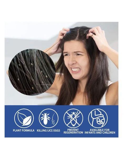 Natural Hair Lice Repellent Spray – Gentle Daily Protection for All Ages - Infinitygallery.store