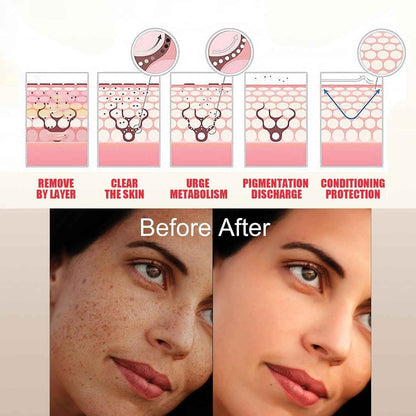 Topicals Faded Serum – Dark Spot Corrector for All Skin Types