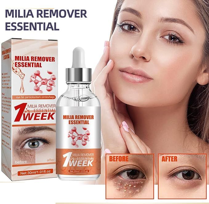 Smooth Milia Remover Serum – 30ml Gentle Skin Smoothing & Hydrating Treatment - Infinitygallery.store