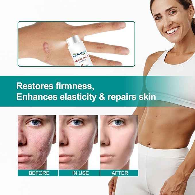 Proregen Medical Scar Removal Spray – Advanced Healing for Acne, Surgical & Burn Scars