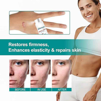 Proregen Medical Scar Removal Spray – Advanced Healing for Acne, Surgical & Burn Scars