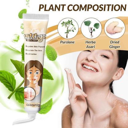 Vitiligo Removal Cream – Restore Skin Pigment & Even Skin Tone Naturally