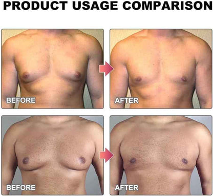 MenTherm Bee Venom Gynecomastia Heating Oil – Firm & Sculpt Male Chest Naturally