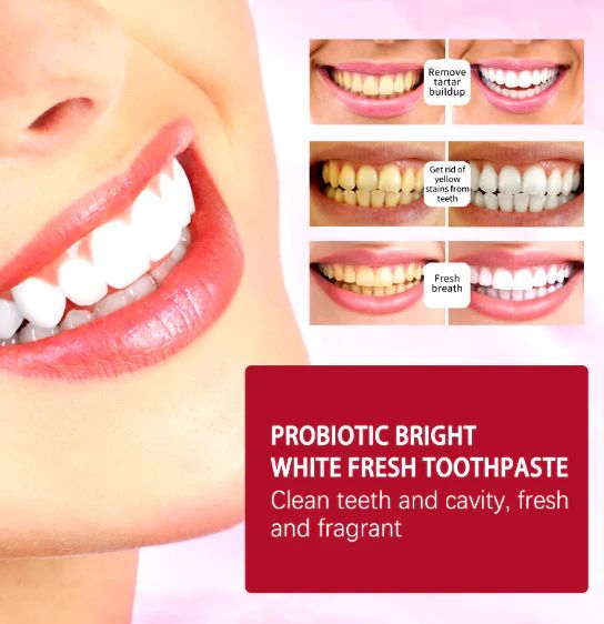 SP-4 Herbal Whitening Toothpaste – 120g Gentle, Natural, & Effective Oral Care - Infinitygallery.store