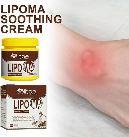 Natural Herbal Body Care Balm – 20g Fat Dissolving & Lipoma Removal Cream - Infinitygallery.store