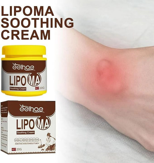 Natural Herbal Body Care Balm – 20g Fat Dissolving & Lipoma Removal Cream - Infinitygallery.store