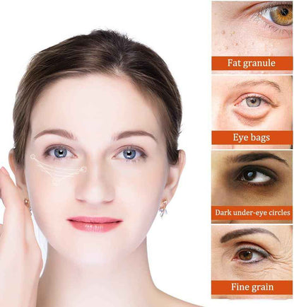 Milia Remover Essential Serum – Eye Fat Particle Removal & Hydration