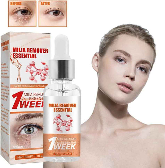 Milia Remover Essential Serum – Eye Fat Particle Removal & Hydration