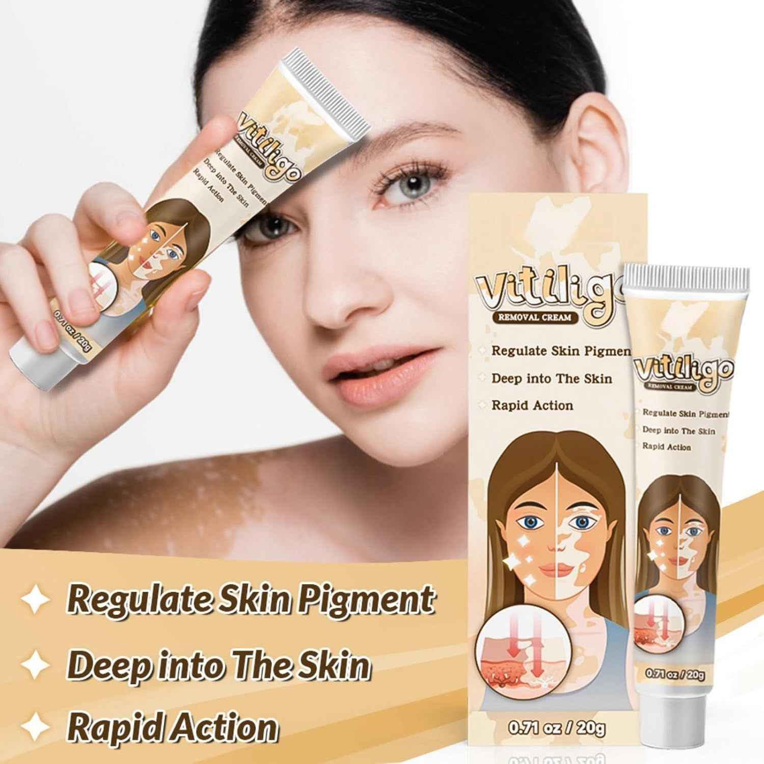 Vitiligo Removal Cream – Restore Skin Pigment & Even Skin Tone Naturally