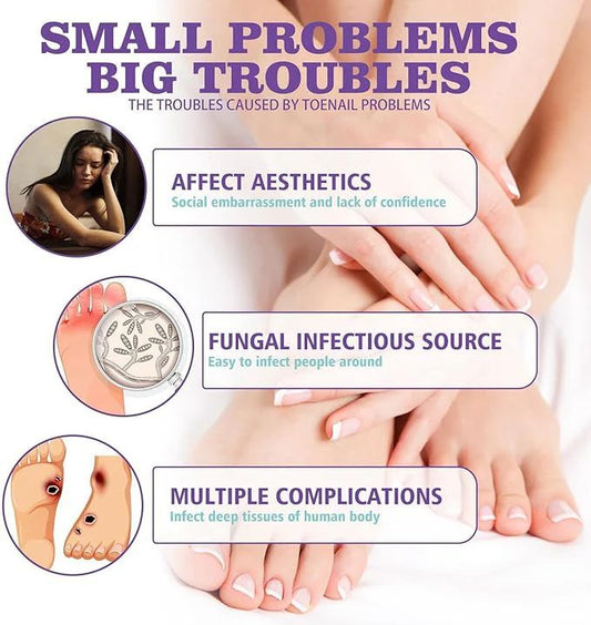 Nail Fungus Treatment Spray – Fast, Safe Relief for Hands & Feet - Infinitygallery.store