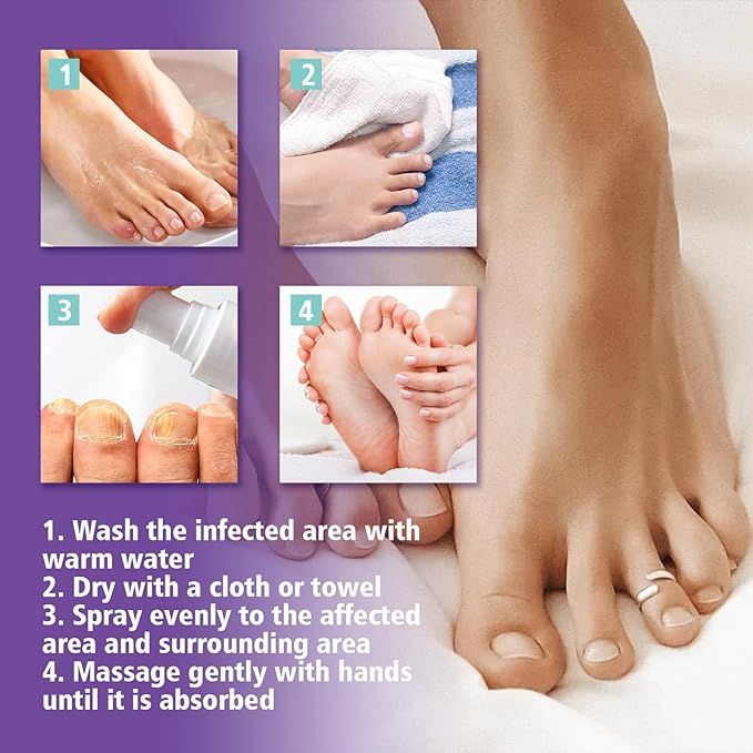 Nail Fungus Treatment Spray – Fast, Safe Relief for Hands & Feet - Infinitygallery.store