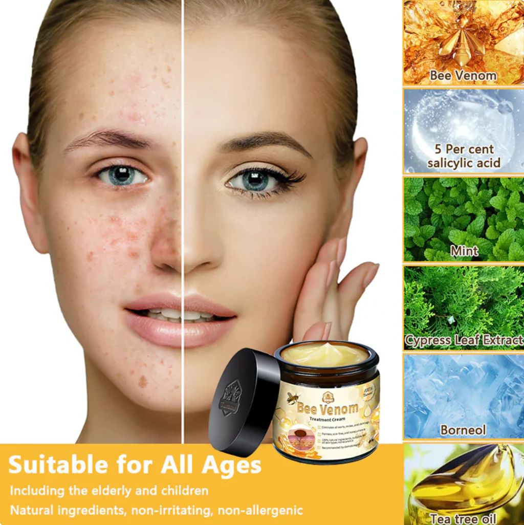 Bee Skin Elixir – Natural Bee Venom Cream for Soothing Relief & Comfort - Infinitygallery.store