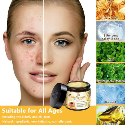 Bee Skin Elixir – Natural Bee Venom Cream for Soothing Relief & Comfort - Infinitygallery.store