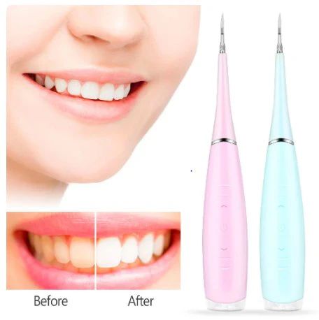 Portable Electric Sonic Dental Scaler – Rechargeable Teeth Cleaning Tool for Plaque & Tartar Removal - Infinitygallery.store